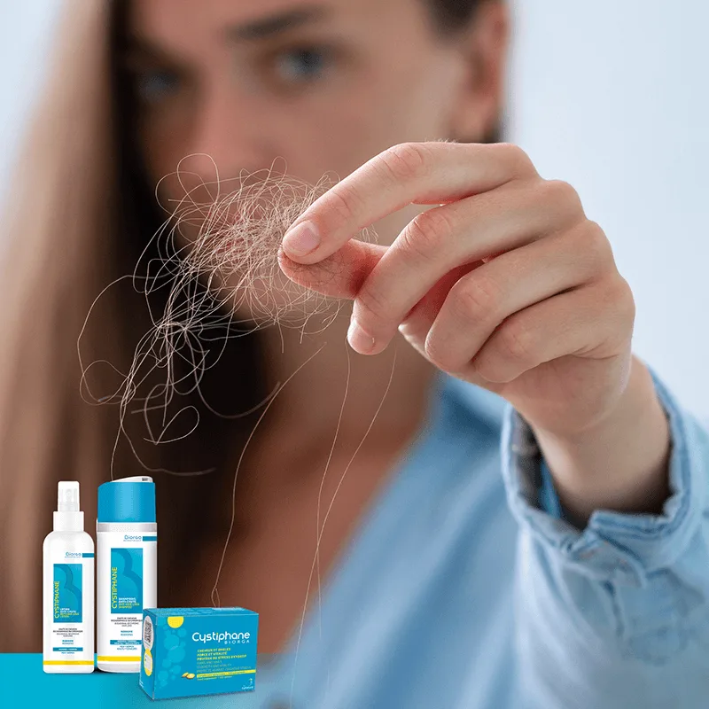 تعرفوا على سبب تساقط الشعر الأكثر شيوعاً عند السيدات و الذي قد تغفل عنه أغلب النساء