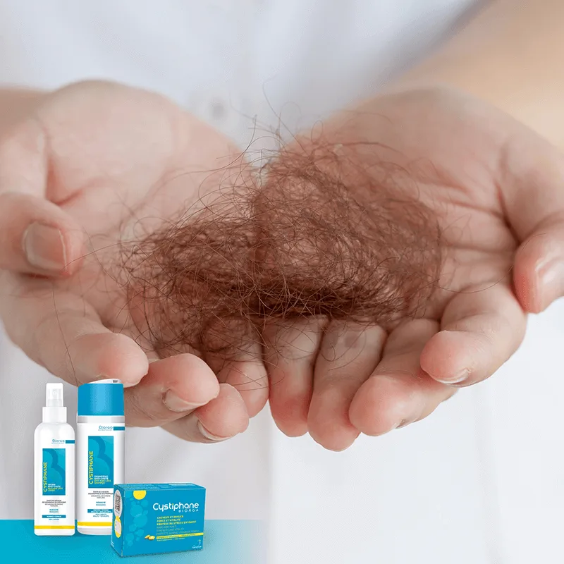 أحدث الطرق المضمونة لعلاج تساقط الشعر